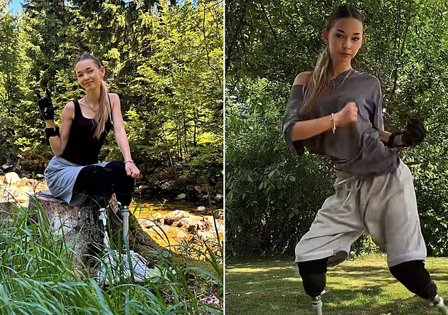 Příběh dívky bez nohou bere dech. Valerie tančí a jde ostatním příkladem