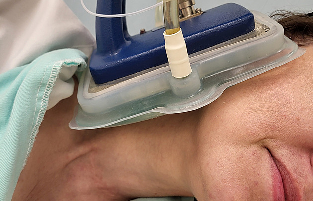 Nádor rakoviny ničí i jeho ohřev, pojišťovny začnou „mikrovlnky“ hradit