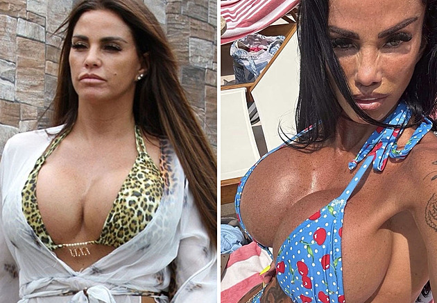 Plastiky ji změnily k nepoznání. Katie Price přiznala přes sto zákroků